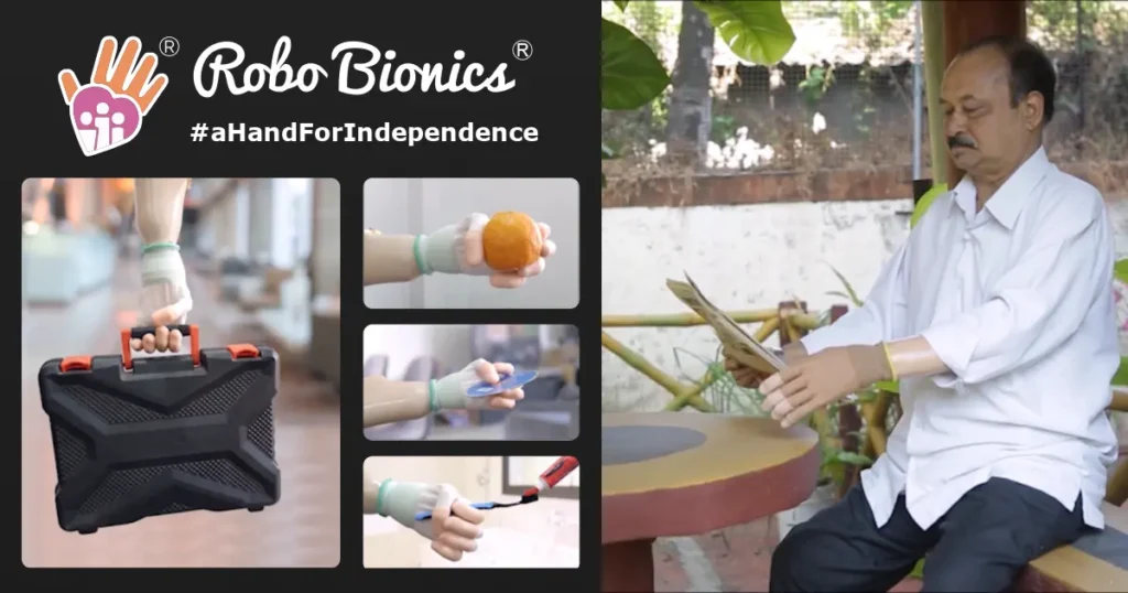 Robo Bionics Revolutionizes Prosthetics with Innovative Grippy Hand