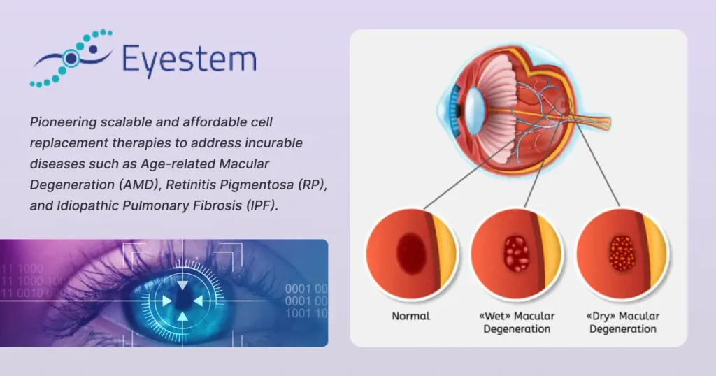 Eyestem Pioneers Scalable Cell Replacement Therapies for Global Health